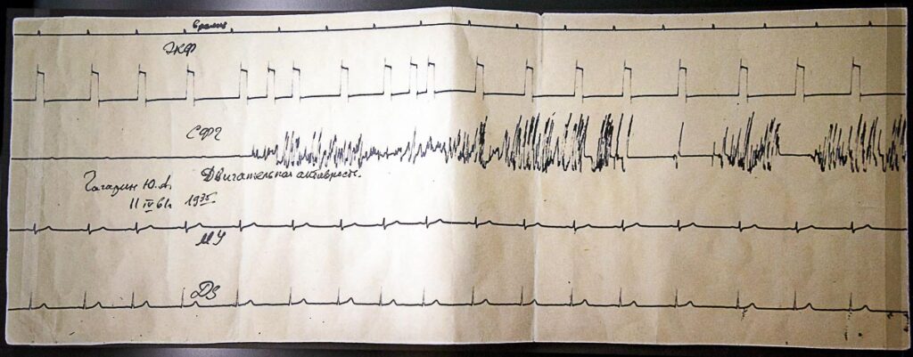 Electrocardiogram of Yuri Gagarin, recorded a few hours before his space launch